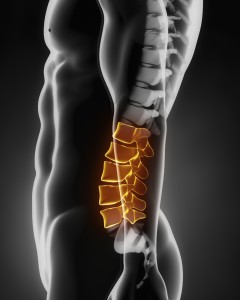 Degenerative Disc Disease Surgery | Princeton Neurological Surgery