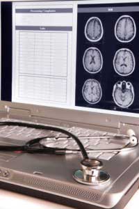Cyberknife Brain Tumor Surgery | Princeton Neurological Surgery