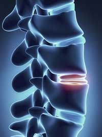 blue illustration of a spine