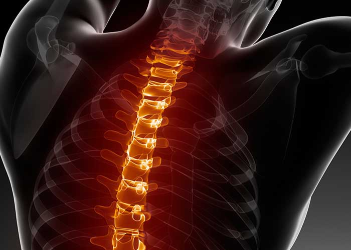 spinalsurgery