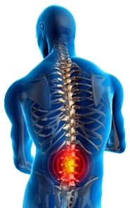 Minimally Invasive Spine Surgery Hamilton NJ