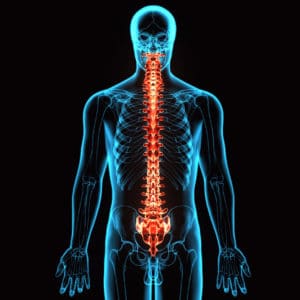 Spinal fusion Hamilton NJ