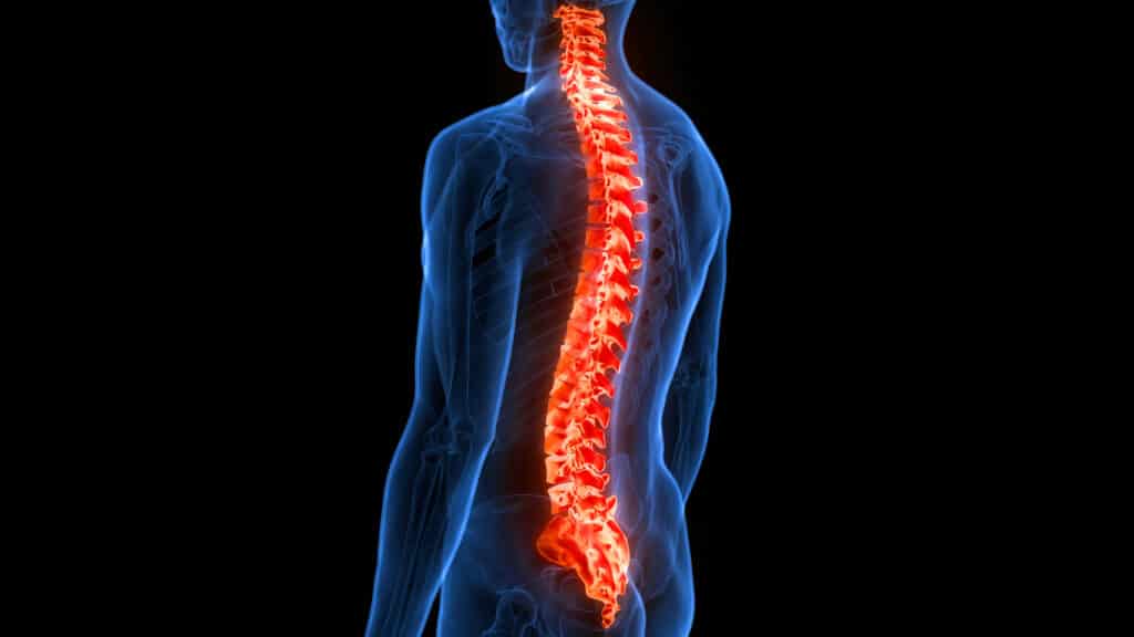 Illustration of the human spine highlighting areas of spinal pain and inflammation.